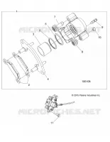 FRENO ANTERIORE CALIPER