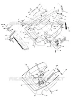 NOSEPAN SuperTrak (4921292129005A)