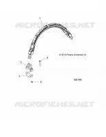 STERZO HOOP